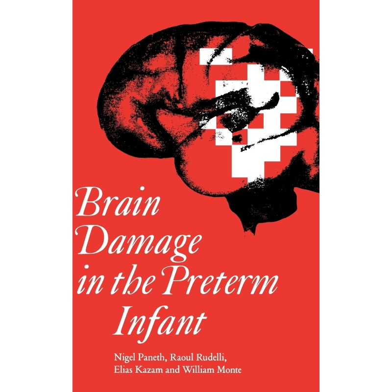 预订，预计下单后2-3周左右发货！