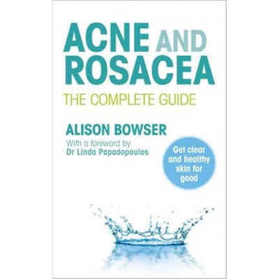 预订Acne and Rosacea:The Complete Guide
