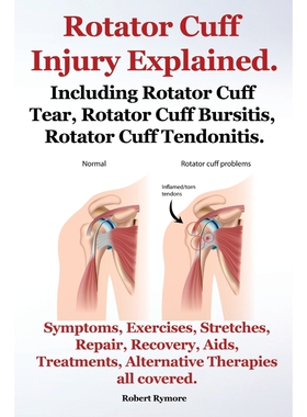 预订Rotator Cuff Injury Explained. Including Rotator Cuff Tear, Rotator Cuff Bursitis, Rotator Cuff Tend
