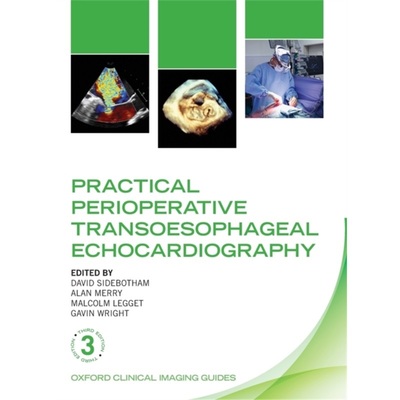 预订不退不换Practical Perioperative Transoesophageal Echocardiography[9780198759089]