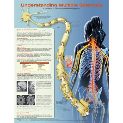 预订Understanding Multiple Sclerosis[9781496394989]