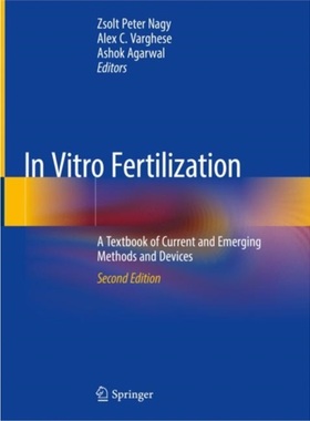 预订In Vitro Fertilization