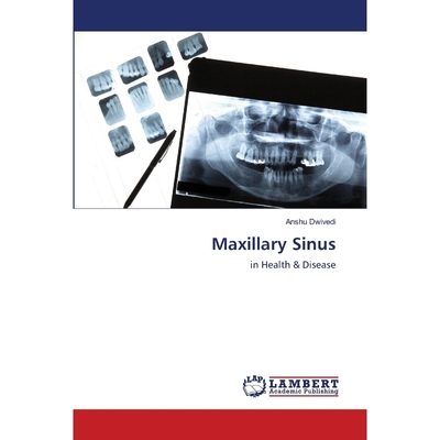 按需印刷不退不换Maxillary Sinus[9786202802673]