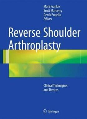 预订不退不换Reverse Shoulder Arthroplasty:Biomechanics, Clinical Techniques, and Current Technologies