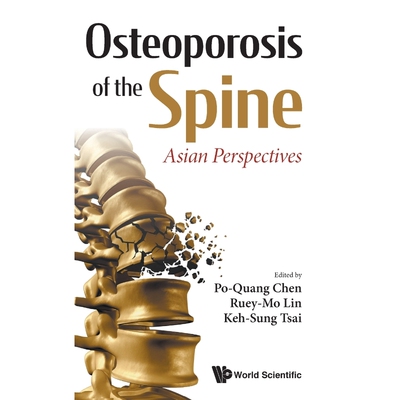 按需印刷不退不换Osteoporosis of the Spine[9789811220807]