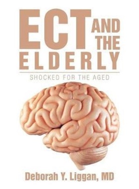 预订Ect and the Elderly