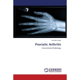 按需印刷Psoriatic Arthritis[9783659431364]