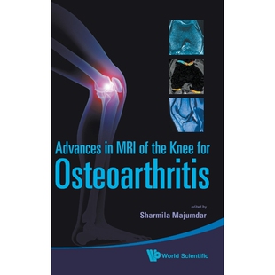 按需印刷Advances in MRI of the Knee for Osteoarthritis[9789814271707]