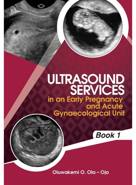 按需印刷Ultrasound Services in An Early Pregnancy and Acute Gynaecological Unit[9781908015075]