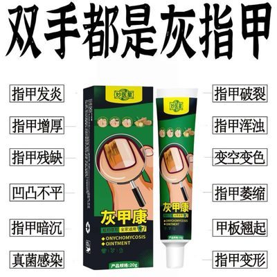 灰指甲脱甲膏专用抑菌液甲沟炎灰趾指甲快速脱甲精油脚指甲软化剂