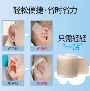 耳朵矫正器婴儿耳廓固定贴招风耳纠正神器新生的宝宝耳垂定型硅胶
