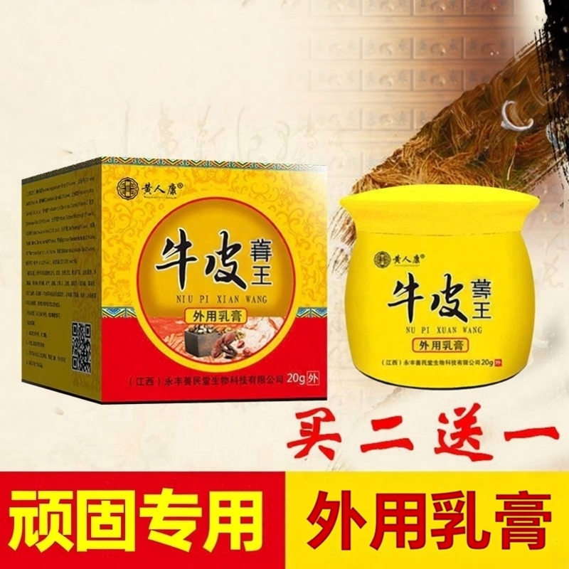 黄人康牛皮手足大腿内侧黑私处体股花斑蘚王乳膏
