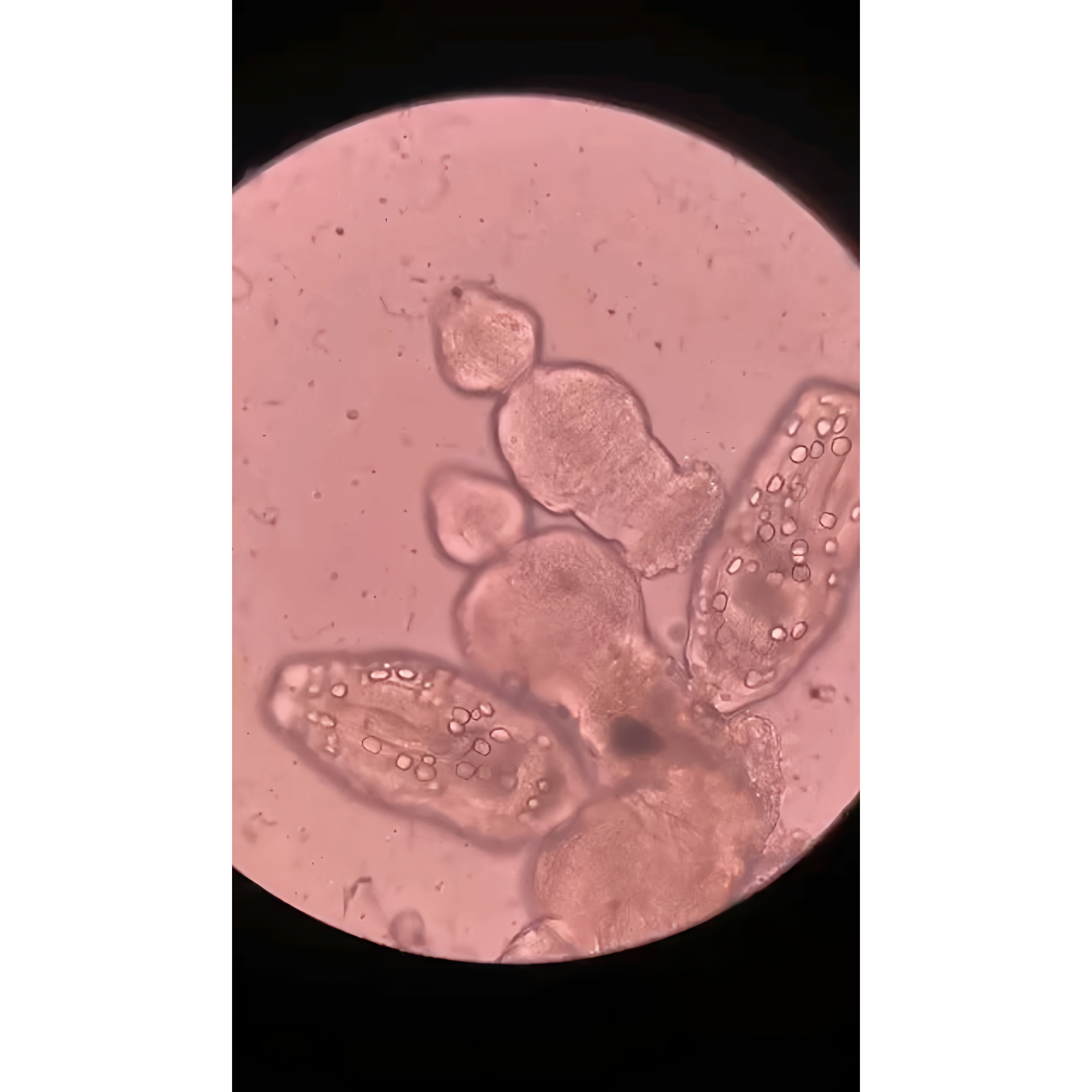 河南教学高校寄生虫虫卵切片