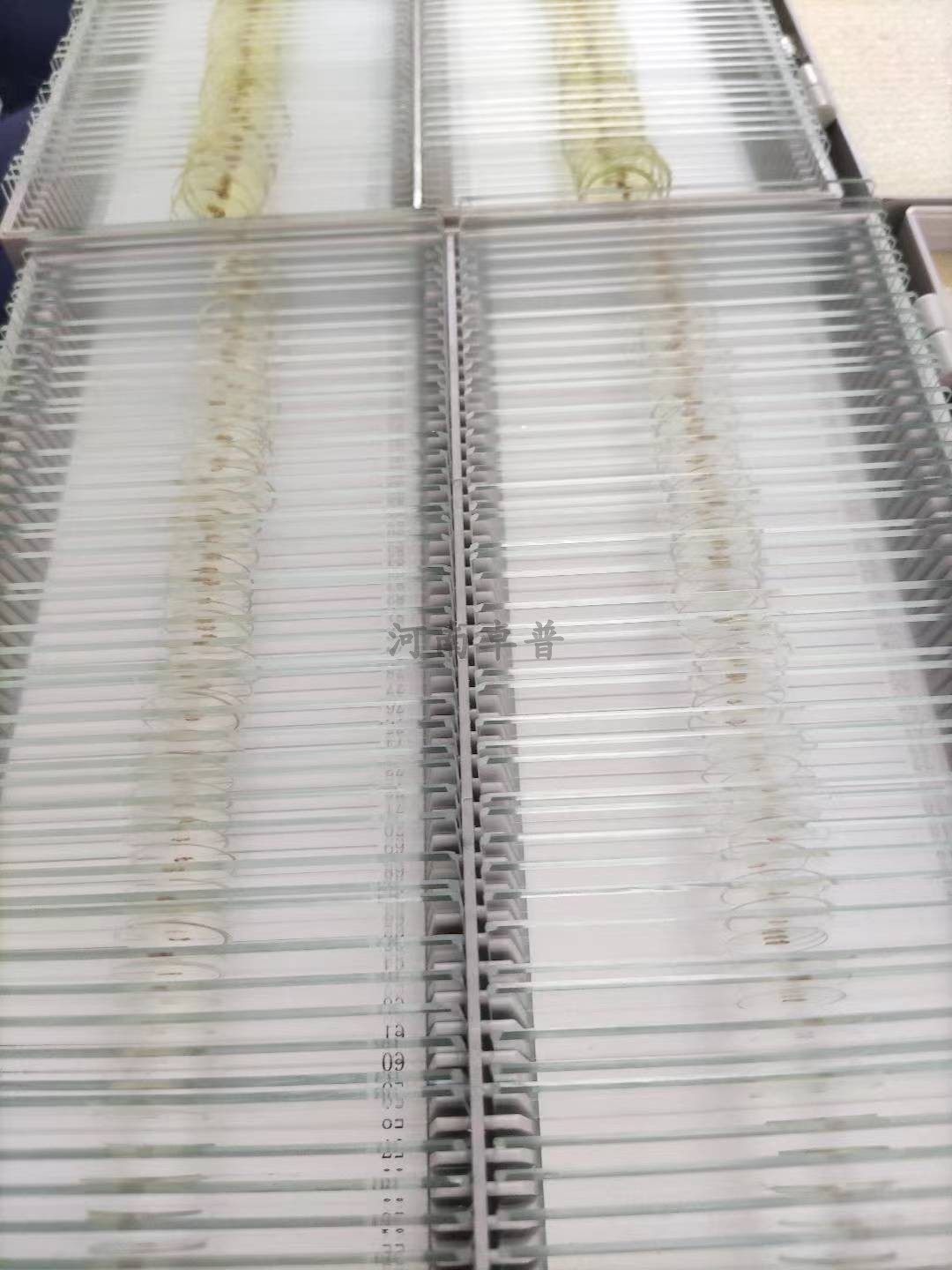 卓普示教肺吸虫 肝吸虫 华枝睾吸虫 成虫囊蚴 布氏姜片虫成虫切片