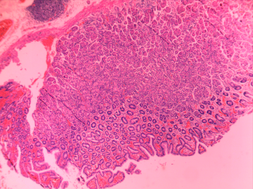 河南卓普教学用品生物玻片法氏囊病 急性卡他性动物组织病理切片
