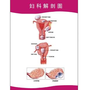 人体器官医学挂图妇科医用解剖海报女性生殖系统结构解剖图示意院
