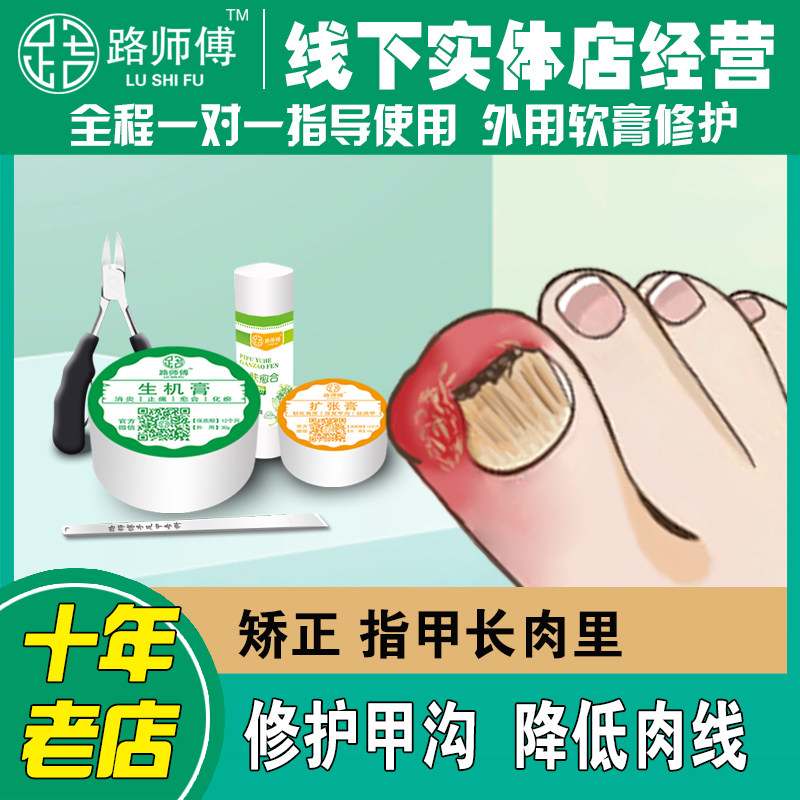 甲沟修护矫正指甲路师傅