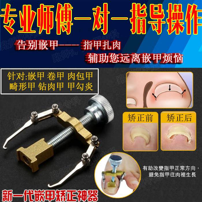路师傅正甲贴甲沟嵌甲矫正器翘甲器 甲沟专用指甲刀剪钳修脚刀炎