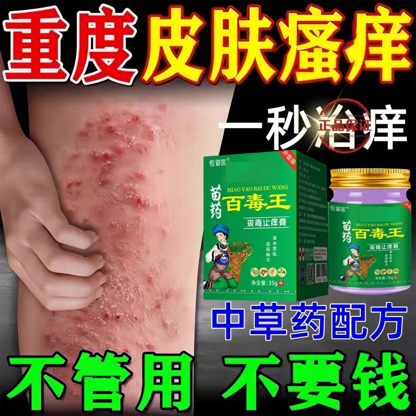 苗药百毒王外用身上瘙痒过敏全身皮肤紫花地丁草本抑菌止/痒乳膏