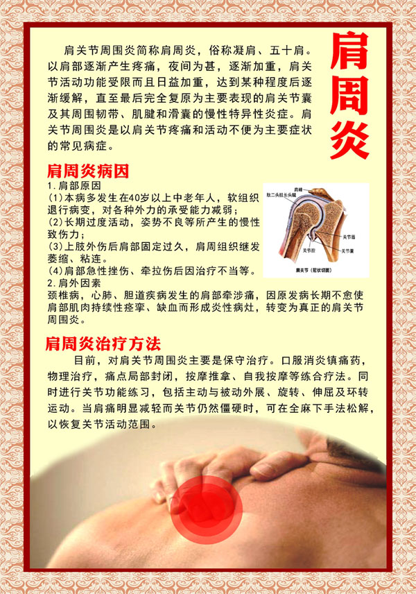 m768中医经络肩周炎的症状和调理疗方法1436海报印制展板写真喷绘