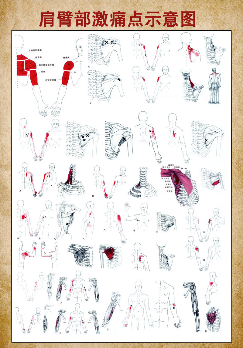 m768骨骼骨架肩臂部激痛点示意图1447海报印制展板写真喷绘挂图