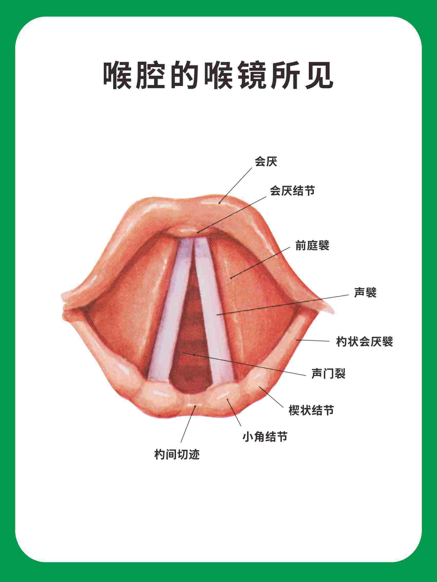 m768医院耳鼻喉科喉腔的喉镜所见挂图2522海报印制喷绘展板59-41