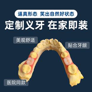 隐形弹性义齿定制树脂活动假牙隐形门牙成人活动义齿种植临时牙齿