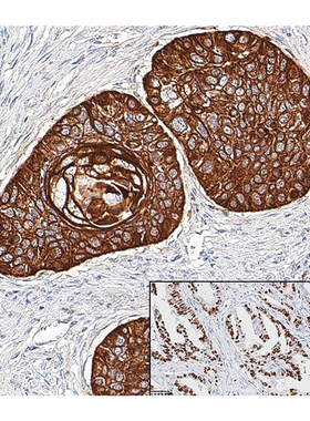 中杉金桥 PV-8000-1-6ml/18ml 超敏酶标山羊抗小鼠/兔 IgG 聚合物
