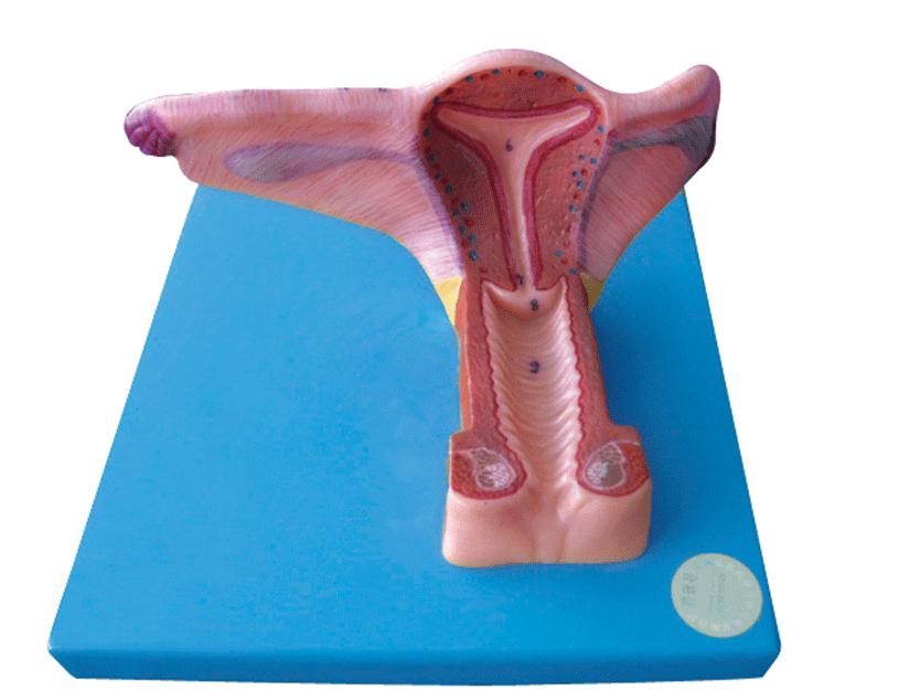 女性内生殖器官模型/解剖模型a15108