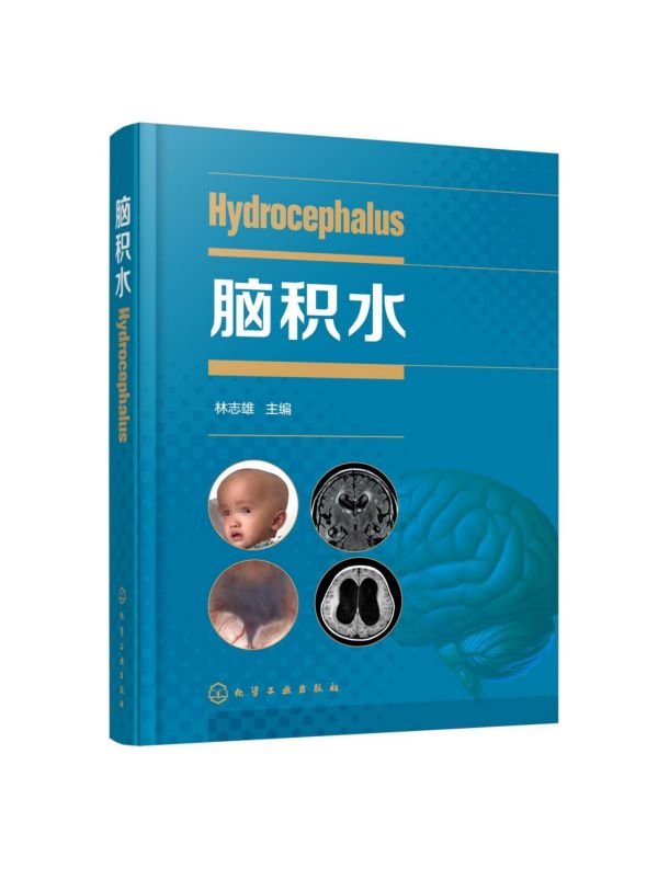 脑积水 精装 脑积水的系统专著 林志雄 脑手术技巧周良辅赵继宗王忠诚 神经外科颅底手术入路 显微外科神经内镜 神经外科学书籍
