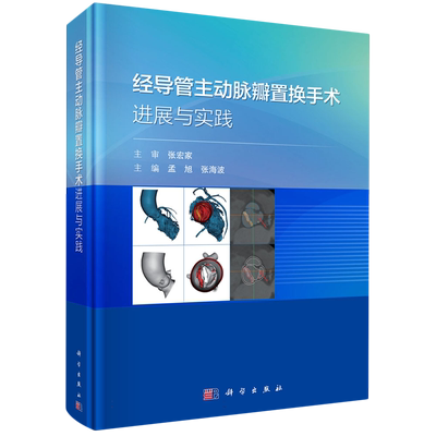 经导管主动脉瓣置换手术进展与实践