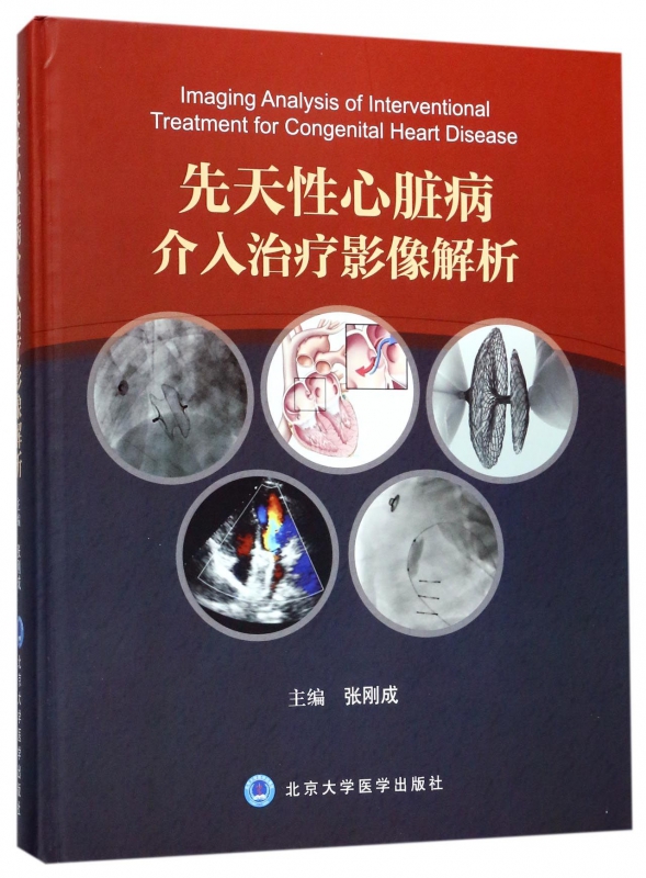 先天性心脏病介入治疗影像解析(精)