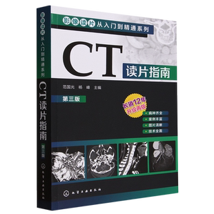 CT读片指南(第3版)/影像读片从入门到精通系列