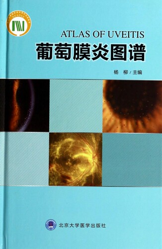 葡萄膜炎图谱(精)