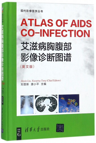 【正版包邮】艾滋病胸腹部影像诊断图谱(英文版)(精)/现代影像医学丛书