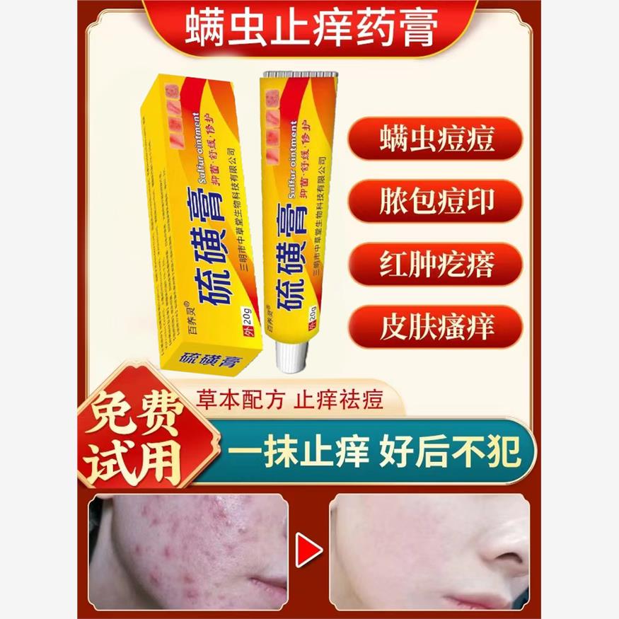 螨虫特效药止痒药除螨祛