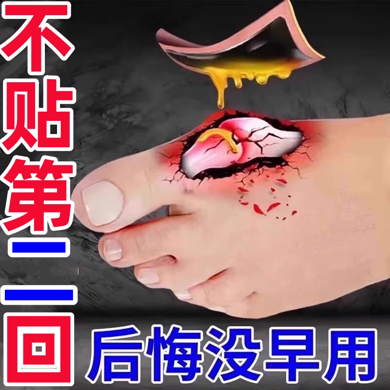【已愈100万人】草本植物脚趾重叠防磨大脚骨走路困难矫姿专用贴图片