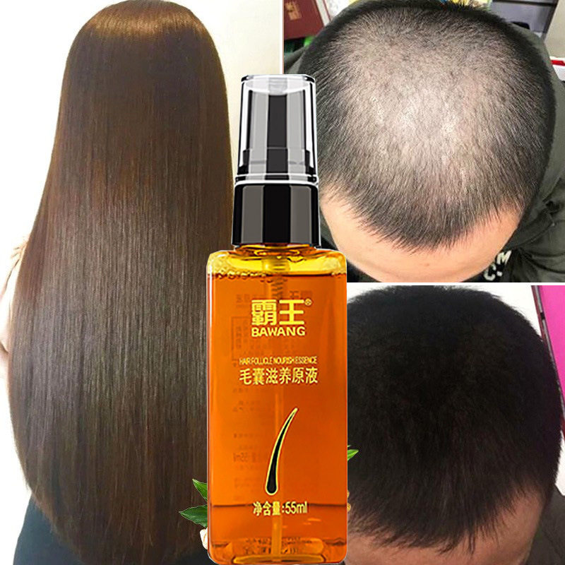霸王毛囊滋养原液头皮营养液55ml头发护理喷雾控油育发防断发