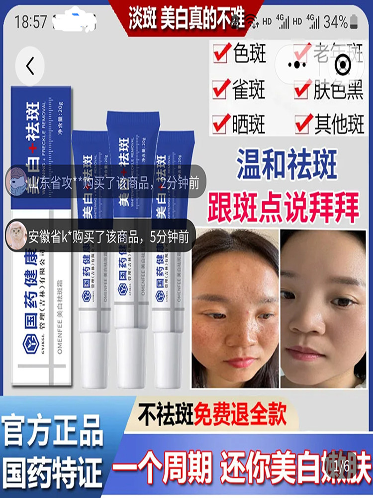 国药健康美白祛斑霜淡雀斑老年斑
