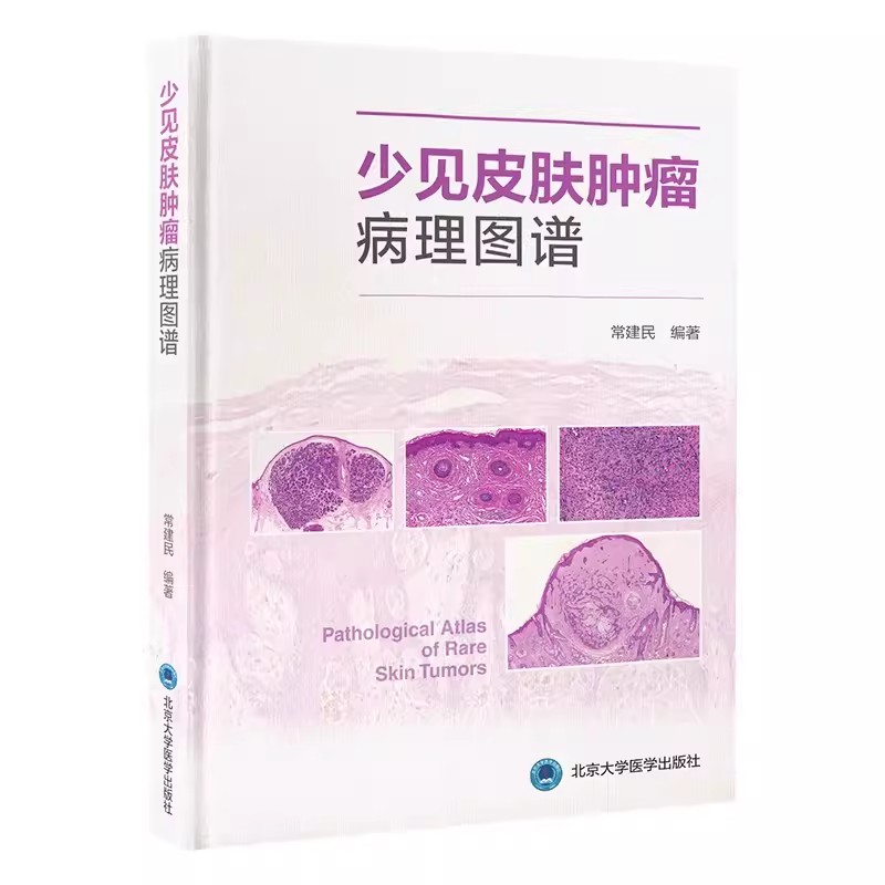 正版少见皮肤肿瘤病理图谱 克隆型脂溢性角化病等肿瘤临床病理学特征 常建民 北京大学医学出版社 少见皮肤肿瘤病理图谱教材教程书