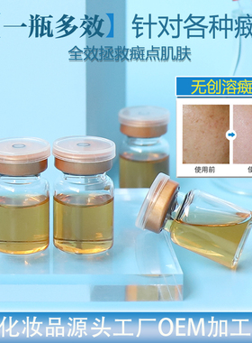 无创溶癍液5mlM白D斑精华液微晶分解液黑色素淡化黄褐癍色癍雀癍