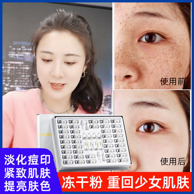 冻干粉祛痘印修复淡化痘印肌肤屏障受损修护紧致女正品官方补水保