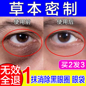 眼袋去除神器男士女专用淡化细纹提拉紧致去黑眼圈咖啡因正品眼霜