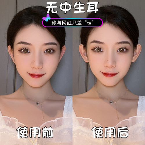 无耳洞精灵耳贴神器招风立耳