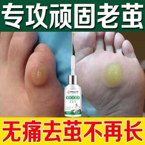 正品香港大药房老茧手茧脚茧脚底手部茧厚皮脚垫净死皮根硬软化剂