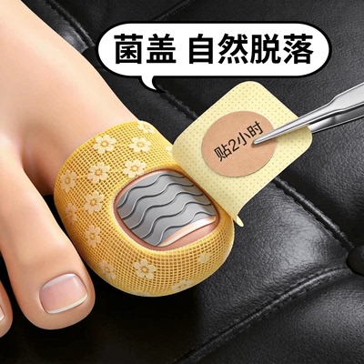 【国药甄选】草本专用净甲除甲贴植物萃取正品脚趾手指甲通用