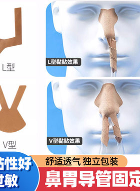 伤迪鼻饲管胃管固定鼻贴体表导管固定贴装置胶布带导管固定器