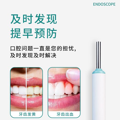 口腔镜牙齿内窥镜头皮毛囊发皮肤检测仪有线连接手机检测多功能