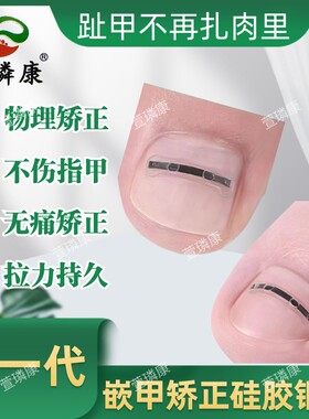 甲沟嵌甲矫正钢丝贴片硅胶加钛合金片双效结合快速纠正趾甲矫正器