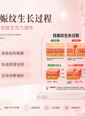 妊娠纹生长过程亚克力摆台孕产皮肤科普宣教展示护理机构讲解教具